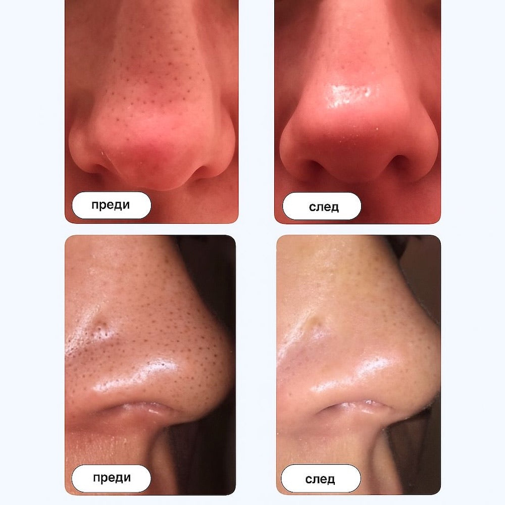 GLOWL Ленти за дълбоко почистване на порите